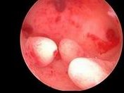 试管婴儿备孕检查的内容哪些？试管婴儿备孕前的检查事项，试管婴儿检查项目孩子生的区别